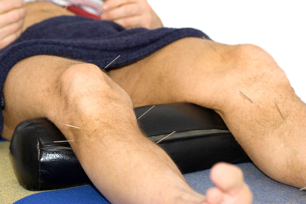 Is Dry Needling Right for You